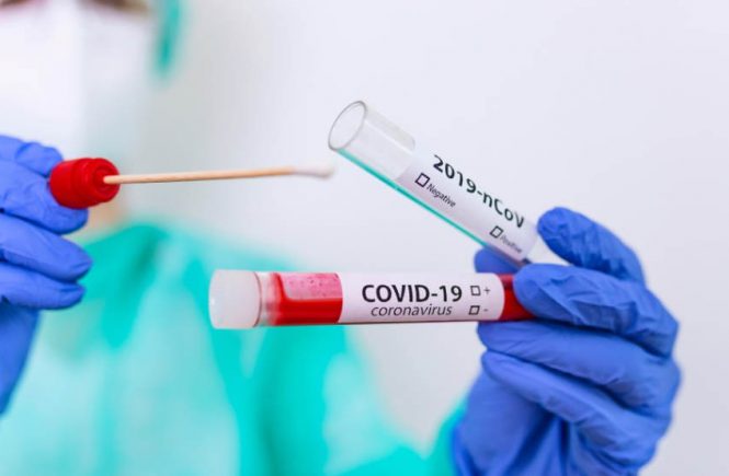 covid-19